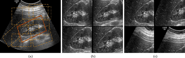 Figure 1 for Understanding the Mechanisms of Deep Transfer Learning for Medical Images