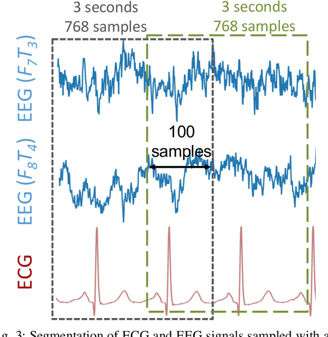 Figure 4 for Many-to-One Knowledge Distillation of Real-Time Epileptic Seizure Detection for Low-Power Wearable Internet of Things Systems