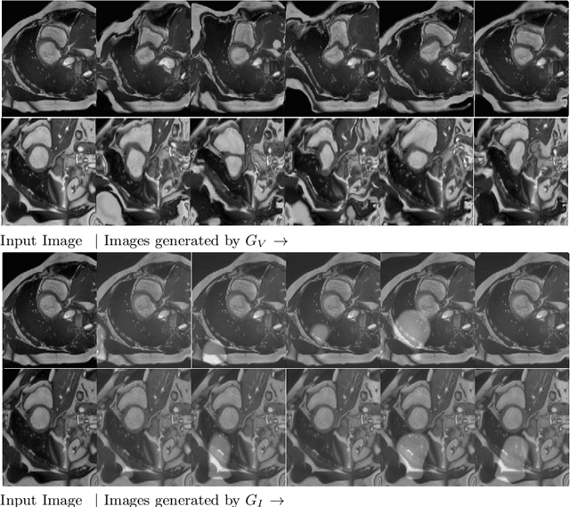 Figure 4 for Semi-Supervised and Task-Driven Data Augmentation