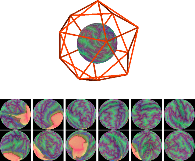 Figure 1 for Multi-view Attention for gestational age at birth prediction