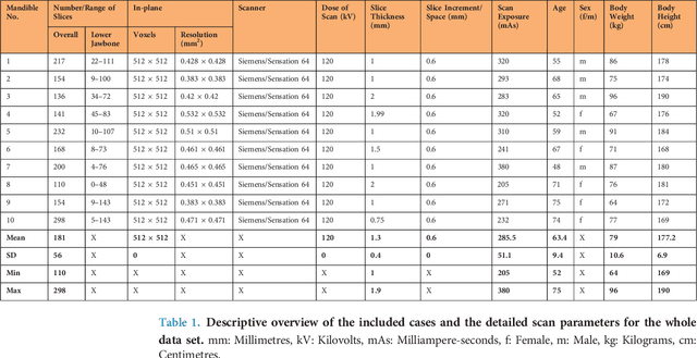 Figure 1 for Computed tomography data collection of the complete human mandible and valid clinical ground truth models