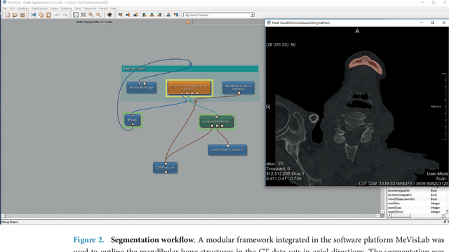 Figure 3 for Computed tomography data collection of the complete human mandible and valid clinical ground truth models
