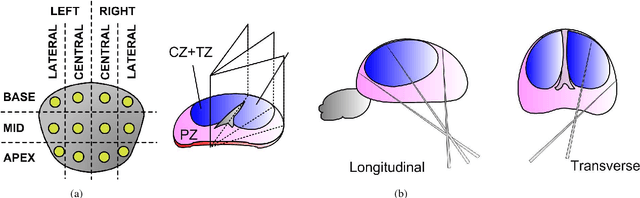 Figure 3 for Prostate biopsy tracking with deformation estimation