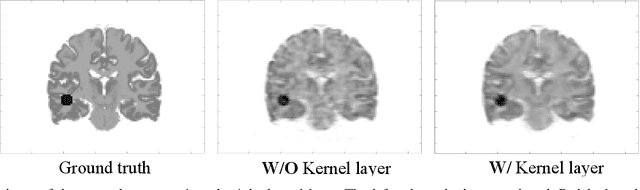 Figure 4 for Direct Reconstruction of Linear Parametric Images from Dynamic PET Using Nonlocal Deep Image Prior