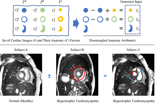 Figure 1 for Controllable cardiac synthesis via disentangled anatomy arithmetic