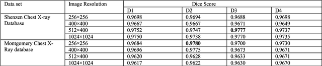 Figure 4 for Segmentation of Lungs in Chest X-Ray Image Using Generative Adversarial Networks