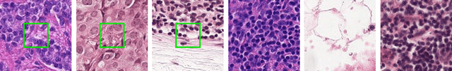 Figure 1 for Rotaflip: A New CNN Layer for Regularization and Rotational Invariance in Medical Images
