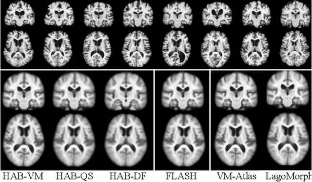 Figure 2 for Hybrid Atlas Building with Deep Registration Priors