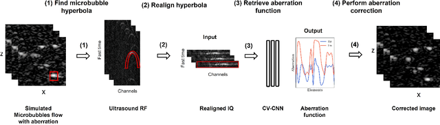 Figure 1 for Phase Aberration Correction for in vivo Ultrasound Localization Microscopy Using a Spatiotemporal Complex-Valued Neural Network
