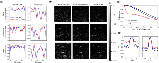 Figure 4 for Phase Aberration Correction for in vivo Ultrasound Localization Microscopy Using a Spatiotemporal Complex-Valued Neural Network