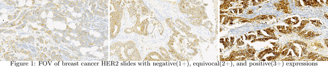 Figure 1 for Automated Scoring System of HER2 in Pathological Images under the Microscope