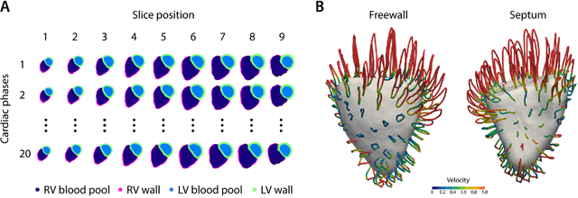 Figure 1 for Deep learning cardiac motion analysis for human survival prediction