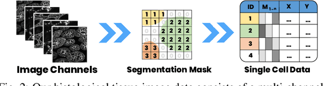 Figure 1 for Scope2Screen: Focus+Context Techniques for Pathology Tumor Assessment in Multivariate Image Data
