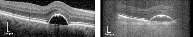 Figure 1 for Segmentation of Retinal Low-Cost Optical Coherence Tomography Images using Deep Learning