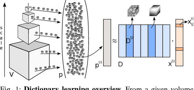 Figure 1 for Automated Multiscale 3D Feature Learning for Vessels Segmentation in Thorax CT Images