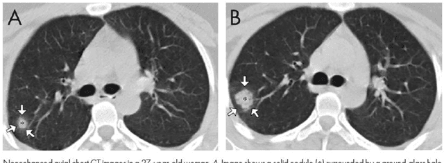 Figure 3 for Computer Vision For COVID-19 Control: A Survey