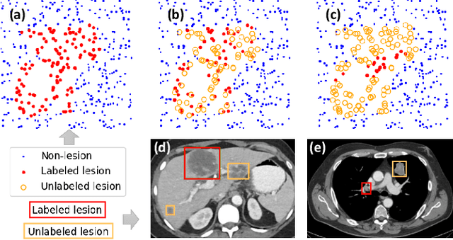 Figure 1 for Learning from Multiple Datasets with Heterogeneous and Partial Labels for Universal Lesion Detection in CT