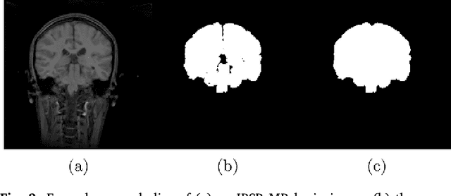 Figure 3 for Brain Extraction from Normal and Pathological Images: A Joint PCA/Image-Reconstruction Approach