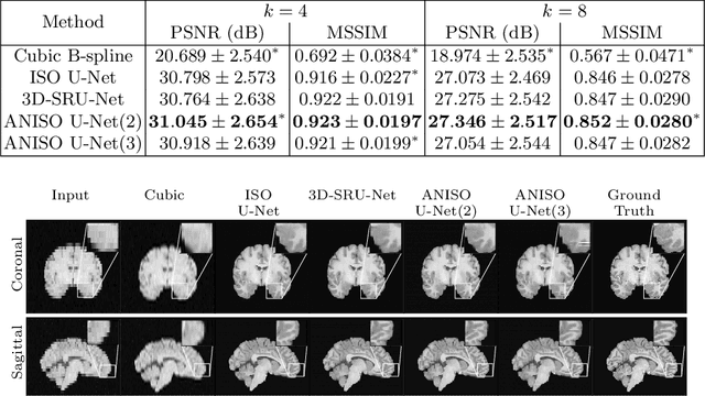 Figure 4 for Deep Learning for Low-Field to High-Field MR: Image Quality Transfer with Probabilistic Decimation Simulator