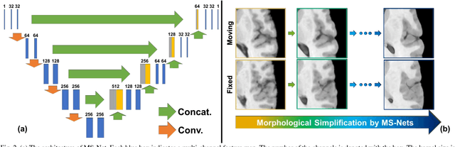 Figure 2 for Deep Morphological Simplification Network (MS-Net) for Guided Registration of Brain Magnetic Resonance Images