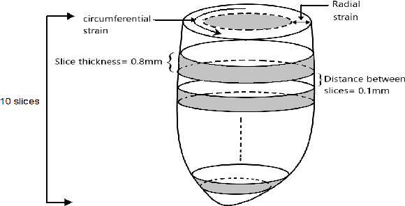 Figure 1 for A Novel Data-Driven Method for the Analysis and Reconstruction of Cardiac Cine MRI