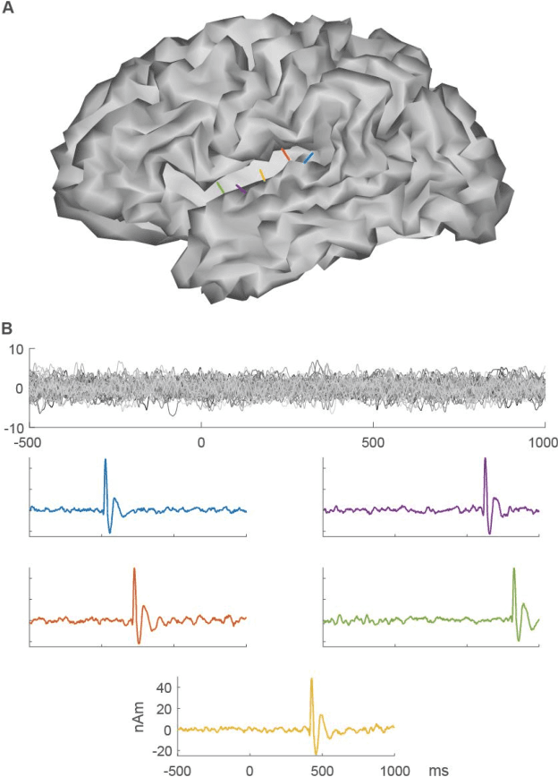 Figure 3 for Contextual Minimum-Norm Estimates (CMNE): A Deep Learning Method for Source Estimation in Neuronal Networks