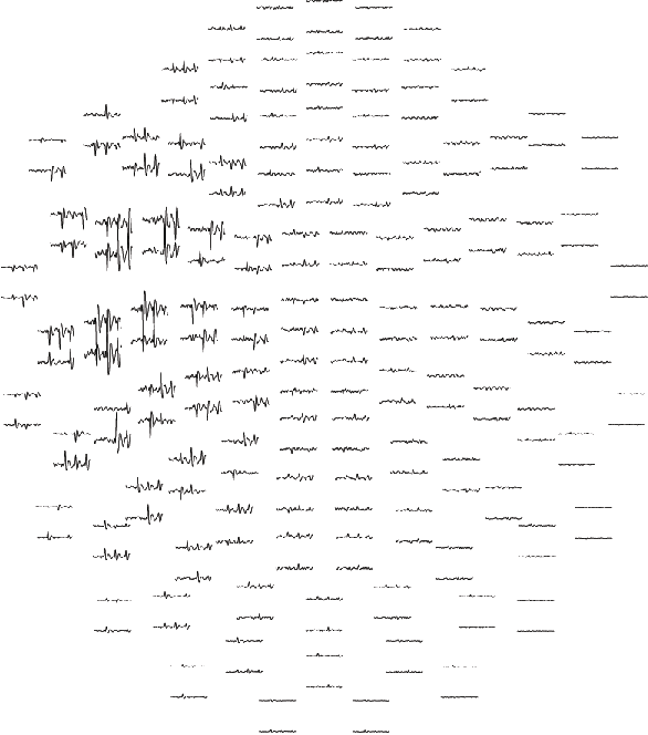 Figure 4 for Contextual Minimum-Norm Estimates (CMNE): A Deep Learning Method for Source Estimation in Neuronal Networks