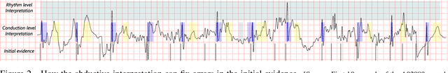 Figure 3 for Arrhythmia Classification from the Abductive Interpretation of Short Single-Lead ECG Records