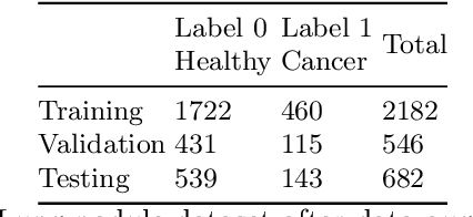Figure 2 for Anomaly Detection for imbalanced datasets with Deep Generative Models