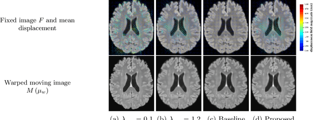 Figure 1 for Uncertainty quantification in non-rigid image registration via stochastic gradient Markov chain Monte Carlo