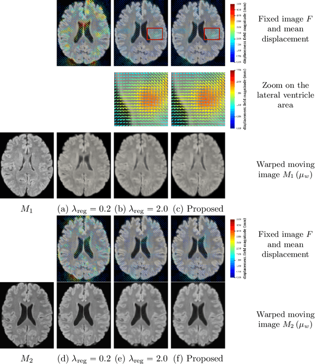 Figure 2 for Uncertainty quantification in non-rigid image registration via stochastic gradient Markov chain Monte Carlo