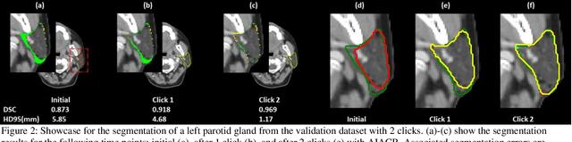 Figure 3 for A Proof-of-Concept Study of Artificial Intelligence Assisted Contour Revision