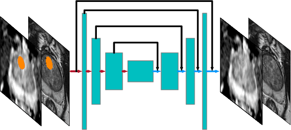 Figure 1 for Prostate cancer inference via weakly-supervised learning using a large collection of negative MRI