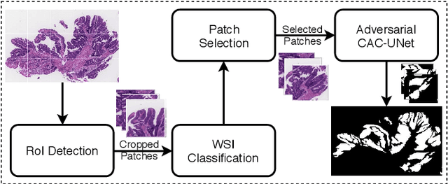 Figure 3 for Multi-level colonoscopy malignant tissue detection with adversarial CAC-UNet