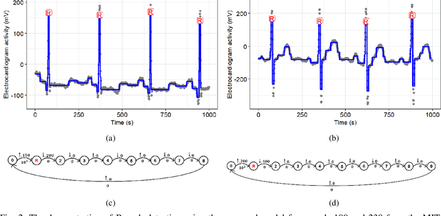 Figure 2 for A Graph-constrained Changepoint Detection Approach for ECG Segmentation