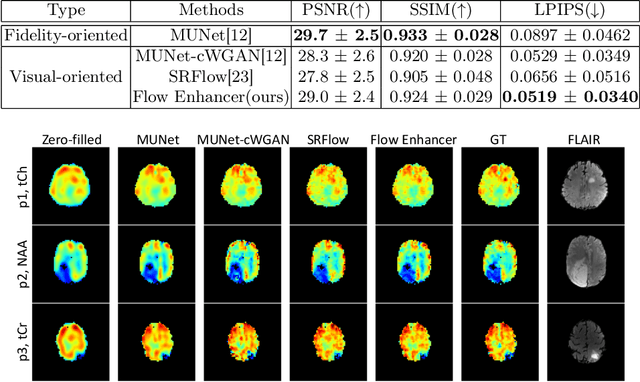 Figure 2 for Flow-based Visual Quality Enhancer for Super-resolution Magnetic Resonance Spectroscopic Imaging