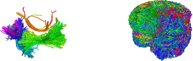 Figure 1 for TRAKO: Efficient Transmission of Tractography Data for Visualization