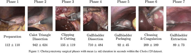Figure 1 for Less is More: Surgical Phase Recognition with Less Annotations through Self-Supervised Pre-training of CNN-LSTM Networks