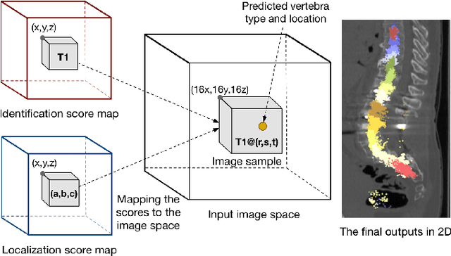 Figure 4 for Joint Vertebrae Identification and Localization in Spinal CT Images by Combining Short- and Long-Range Contextual Information