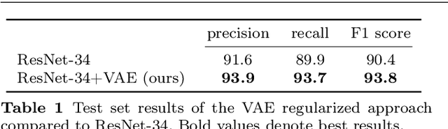 Figure 2 for Retinal OCT disease classification with variational autoencoder regularization