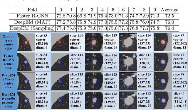 Figure 2 for DeepEM: Deep 3D ConvNets With EM For Weakly Supervised Pulmonary Nodule Detection