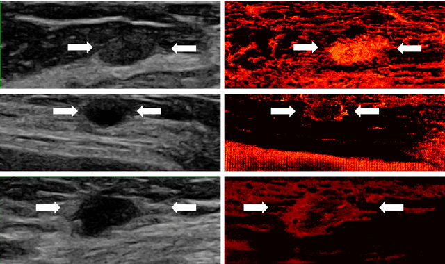 Figure 2 for Deep Algorithm Unrolling for Biomedical Imaging