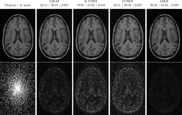 Figure 4 for Deep Algorithm Unrolling for Biomedical Imaging