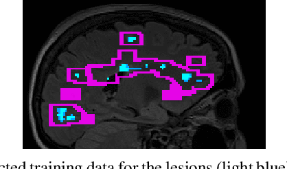 Figure 1 for Multi-compartment diffusion MRI, T2 relaxometry and myelin water imaging as neuroimaging descriptors for anomalous tissue detection