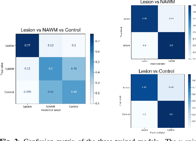 Figure 4 for Multi-compartment diffusion MRI, T2 relaxometry and myelin water imaging as neuroimaging descriptors for anomalous tissue detection