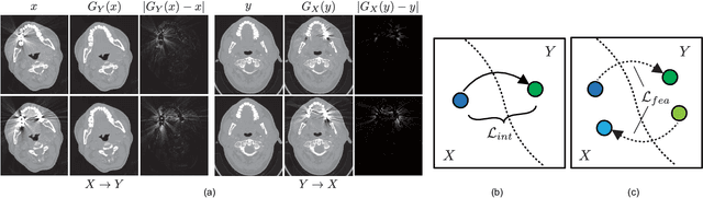 Figure 2 for Three-dimensional Generative Adversarial Nets for Unsupervised Metal Artifact Reduction