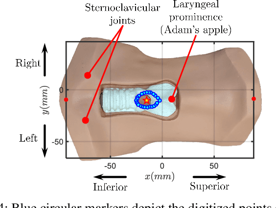 Figure 4 for Feasibility of Remote Landmark Identification for Cricothyrotomy Using Robotic Palpation