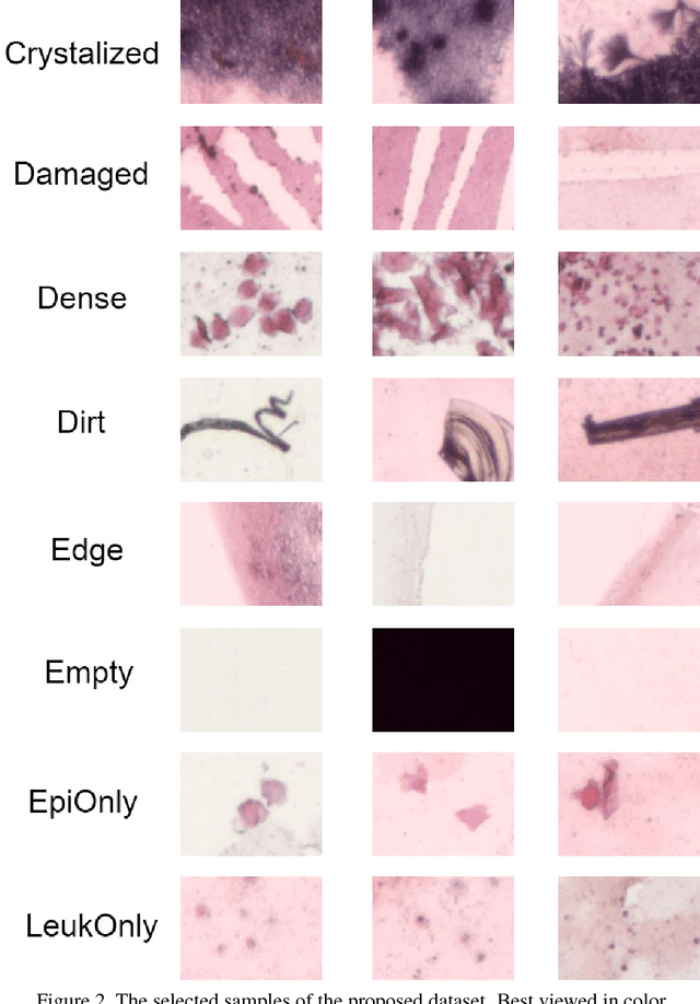 Figure 3 for SlideNet: Fast and Accurate Slide Quality Assessment Based on Deep Neural Networks