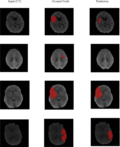 Figure 2 for Ischemic Stroke Lesion Segmentation Using Adversarial Learning