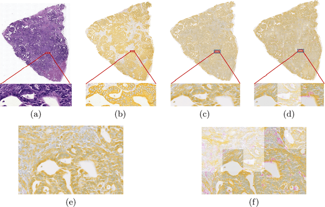 Figure 3 for Perceptual Embedding Consistency for Seamless Reconstruction of Tilewise Style Transfer